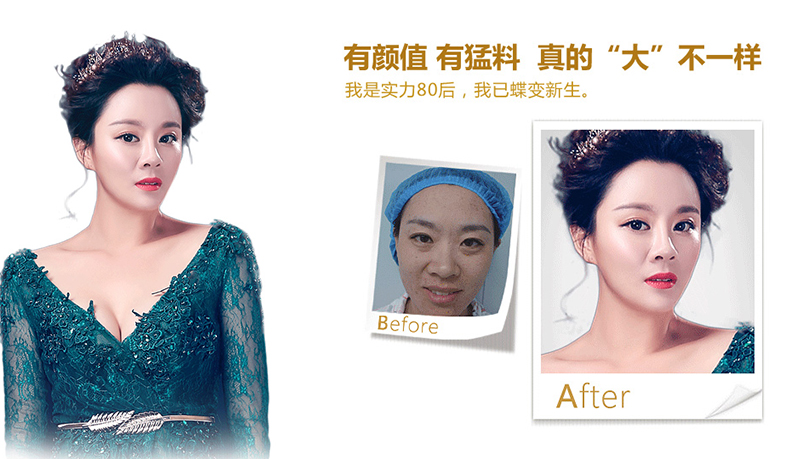 濮阳脂肪移植、隆鼻