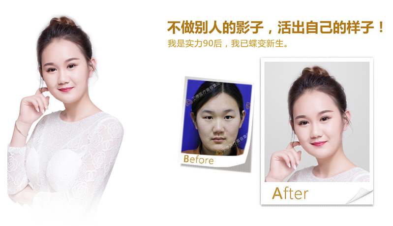 濮阳纳米脂肪移植