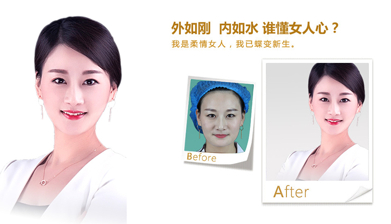 濮阳V脸、线雕隆鼻